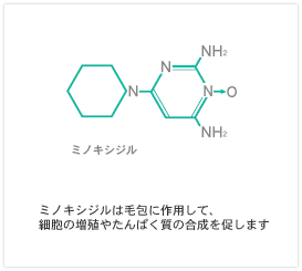 ミノキシジル注射