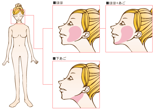 顔の脂肪吸引