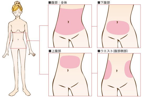 腹部の脂肪吸引