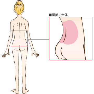 腰部の脂肪吸引