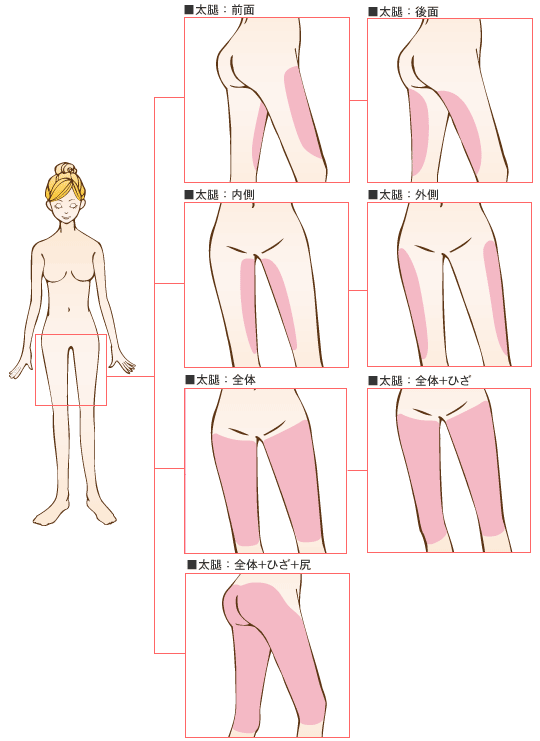 太腿の脂肪吸引