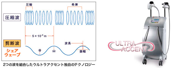 ウルトラアクセントの超音波