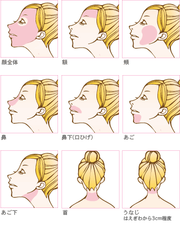 Face(顔)のレーザー脱毛　施術範囲