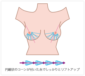 バストアップ3Dリフト