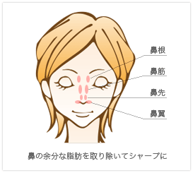 BNLS注射による鼻の輪郭形成