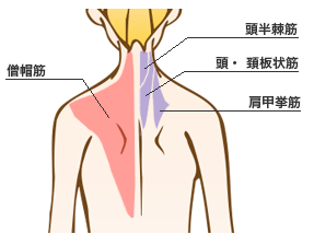 肩こり解消注射