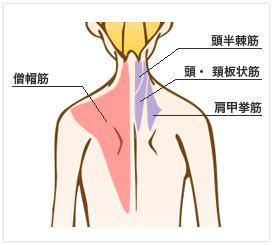 肩こり解消注射