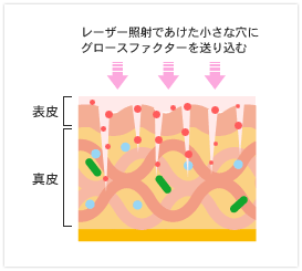 フラクショナルCO2レーザー「プレミアム」コース