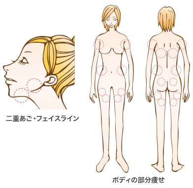 FatXの適応部位