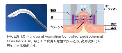 アルマのメカニズム