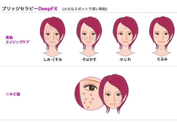 ブリッジセラピーの適応