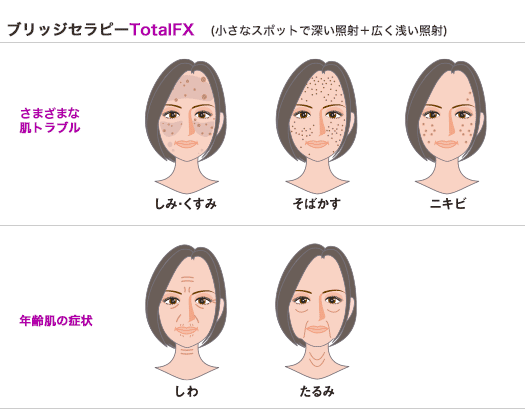 TotalFX の適応