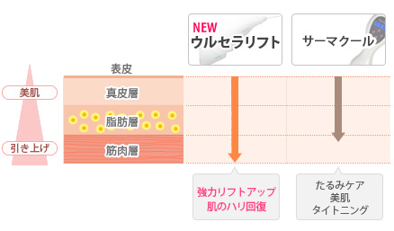 ウルセラリフトとセーマクールの比較