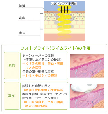 フォトブライト(ライムライト)