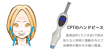 サーマクールCPT