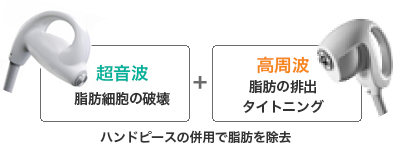ウルトラアクセントで脂肪除去＆タイトニング（ウルトラアクセントのハンドピース）