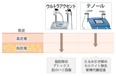 ウルトラアクセント＋テノールのコンビネーション