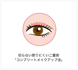 切らない戻りにくい二重術「コンプリートメークアップ法」