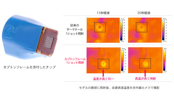 引き締め力がアップしたサーマクールFLX/CPT