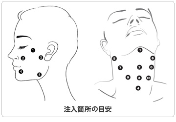 注入箇所の目安