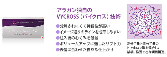 ジュビダームビスタ アラガン社独自のVYCROSS(バイクロス)技術