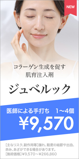ジュベルック