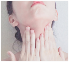 ペリカン手術でアゴ下のたるみ・二重あごを改善